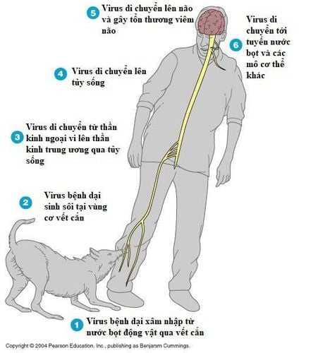 Bệnh dại ở người có chữa được hay không và cách phòng tránh