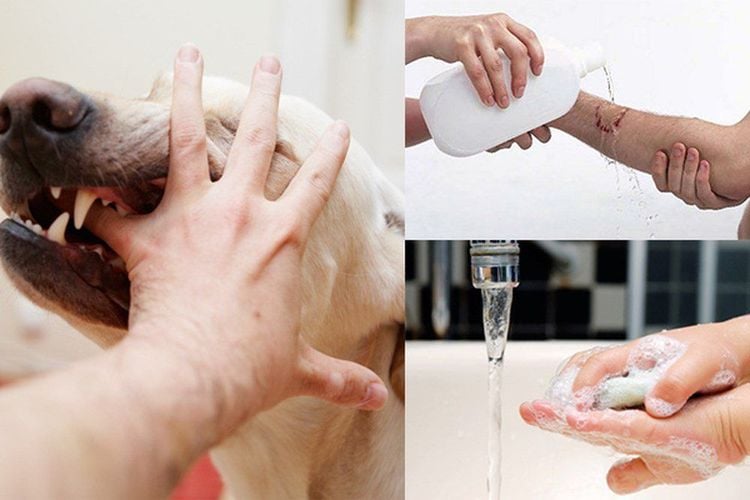 Bệnh dại ở người có chữa được hay không và cách phòng tránh