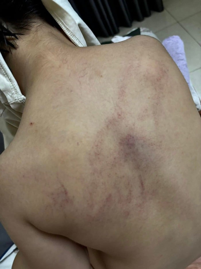 Vụ giáo viên bạo hành trẻ ở Trường Mầm non Gia Thụy, Hà Nội: Thêm 1 giáo viên bị tạm đình chỉ