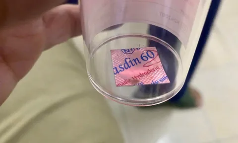 Bệnh viện Lê Văn Việt nội soi gắp viên thuốc còn nguyên vỏ mắc kẹt trong thực quản bệnh nhân