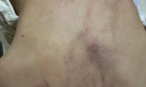 Vụ giáo viên bạo hành trẻ ở Trường Mầm non Gia Thụy, Hà Nội: Thêm 1 giáo viên bị tạm đình chỉ