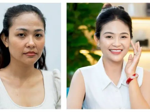 Trẻ hóa da toàn diện: Bước “lột xác” cho một khởi đầu mới