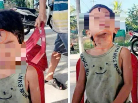 Công an xác minh vụ bé gái 6 tuổi nghi bị cha dượng bạo hành ở Kiên Giang