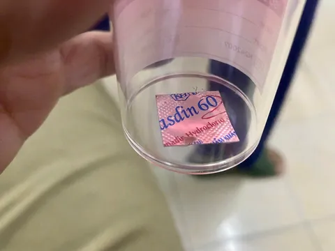 Bệnh viện Lê Văn Việt nội soi gắp viên thuốc còn nguyên vỏ mắc kẹt trong thực quản bệnh nhân