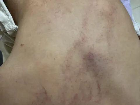 Vụ giáo viên bạo hành trẻ ở Trường Mầm non Gia Thụy, Hà Nội: Thêm 1 giáo viên bị tạm đình chỉ