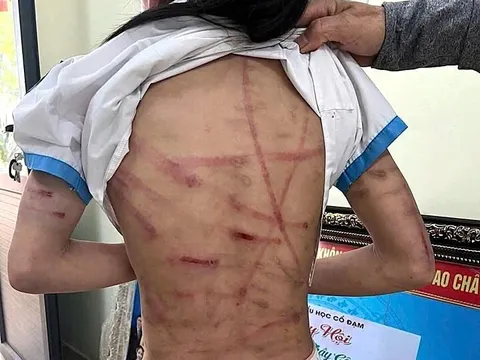 Bắt giữ cha dượng bạo hành dã man bé gái lớp 5 ở Hà Tĩnh